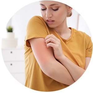 Junge Frau kratzt sich am roten, gereizten Arm wegen Allergie. Symptome sichtbar im Innenraum.